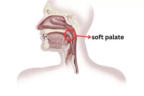 illustration showing the soft palate